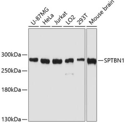 Western Blot: Spectrin beta 2 Antibody [NBP2-93443] - Western blot analysis of extracts of various cell lines, using Spectrin beta 2 antibody (NBP2-93443) at 1:3000 dilution. Secondary antibody: HRP Goat Anti-Rabbit IgG (H+L) at 1:10000 dilution. Lysates/proteins: 25ug per lane. Blocking buffer: 3% nonfat dry milk in TBST. Detection: ECL Basic Kit. Exposure time: 10s.